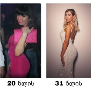 "ნეტა ვინმეს მაინც ეთქვა, რომ მაკიაჟი ასე საერთოდ არ უნდა გამეკეთებინა" - ნახეთ, როგორ გამოიყურებოდა თამო ვაშალომიძე 11 წლის წინ