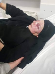 მონაზონი, რომელზეც იძალადეს, უმძიმეს მდგომარეობაშია (ფოტო +18)