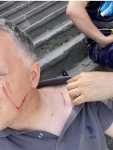 გიორგი ფხაკაძეზე მოქალაქემ იძალადა და დაზიანებები მიაყენა - ზაფხულში მომხდარი გაუხმაურებელი ამბავი