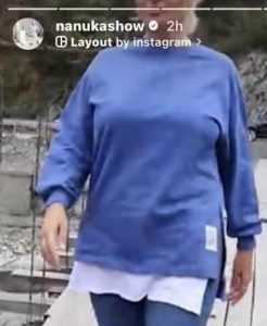 ნანუკა ჟორჟოლიანი პლასტიკურ ოპერაციამდე და მის შემდეგ - რას აქვეყნებს ტელეწამყვანი