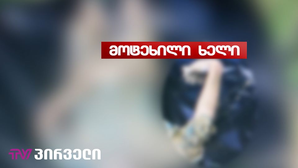 (ვიდეო) ათეულობით ფოტომასალა - მოტეხილი ხელი, დაზიანება თავის და წელის არეში...