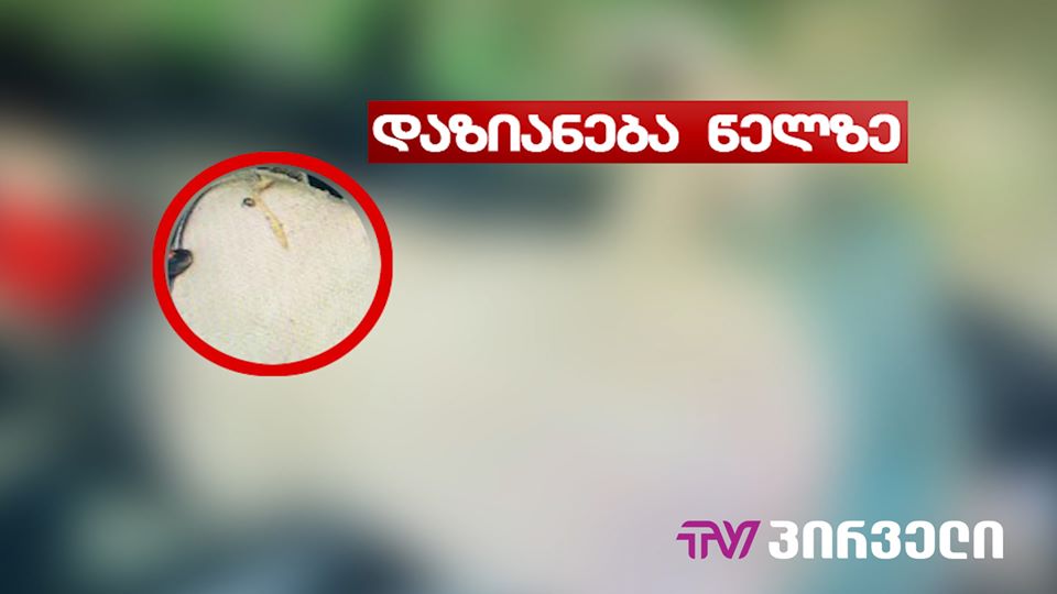 (ვიდეო) ათეულობით ფოტომასალა - მოტეხილი ხელი, დაზიანება თავის და წელის არეში...