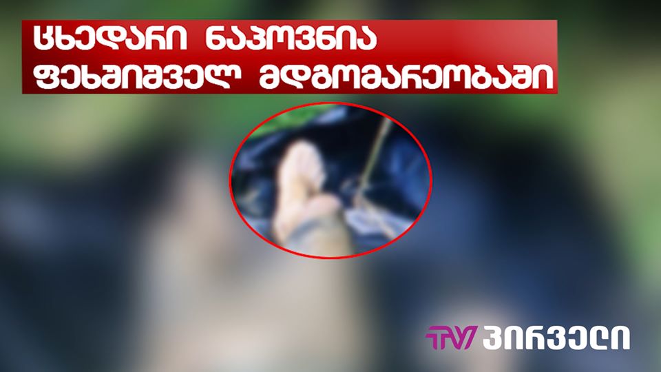 (ვიდეო) ათეულობით ფოტომასალა - მოტეხილი ხელი, დაზიანება თავის და წელის არეში...