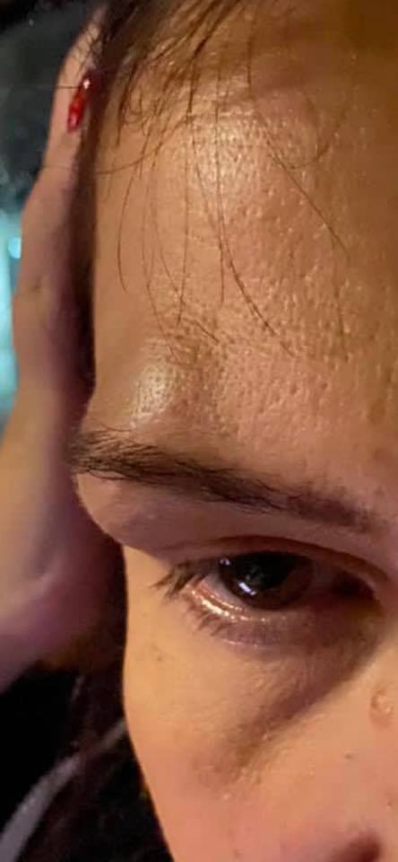 (ფოტო) ინგა გრიგოლია ავარიაში მოყვა