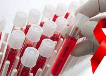 შიდსის ვაქცინის შექმნასთან კიდევ უფრო ახლოს ვართ – პირველი კლინიკური ცდები საიმედოა