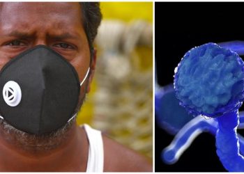 ე.წ.„შავი სოკო“ – რას ნიშნავს დაავადება მუკორმიკოზი, რომელიც ინდოეთში გავრცელდა