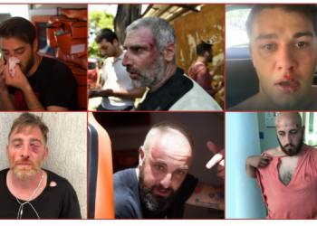 დაშავებულია 40-ზე მეტი ჟურნალისტი და ოპერატორი – Mediachecker სიას აქვეყნებს