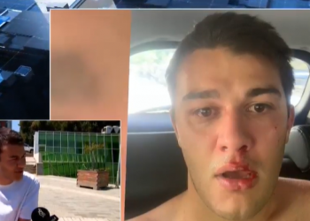 უნდოდათ მოვეკალი, ასამდე პირი მირტყამდა – რას ყვება “ფორმულას” სასტიკად ნაცემი ჟურნალისტი