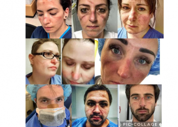 დაიმახსოვეთ გმირები! – “სკაფანდრები ჰერმეტულებია, კანი ვერ სუნთქავს, დიდი რაოდენობით გამოიყოფა ოფლი, წურწურით ჩამოსდით… –  წამების ტოლფასია”