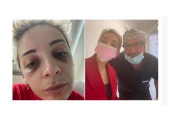 წავიქეცი, სახის მძიმე ტრავმა მივიღე, ჩამემსხვრა კბილები, დამჭირდა ქირურგიული ჩარევა… – “იმედზე” არ უნდა მუშაობდე, დატოვეო – ქეთევან ქარდავა კრიტიკოსებს პასუხობს