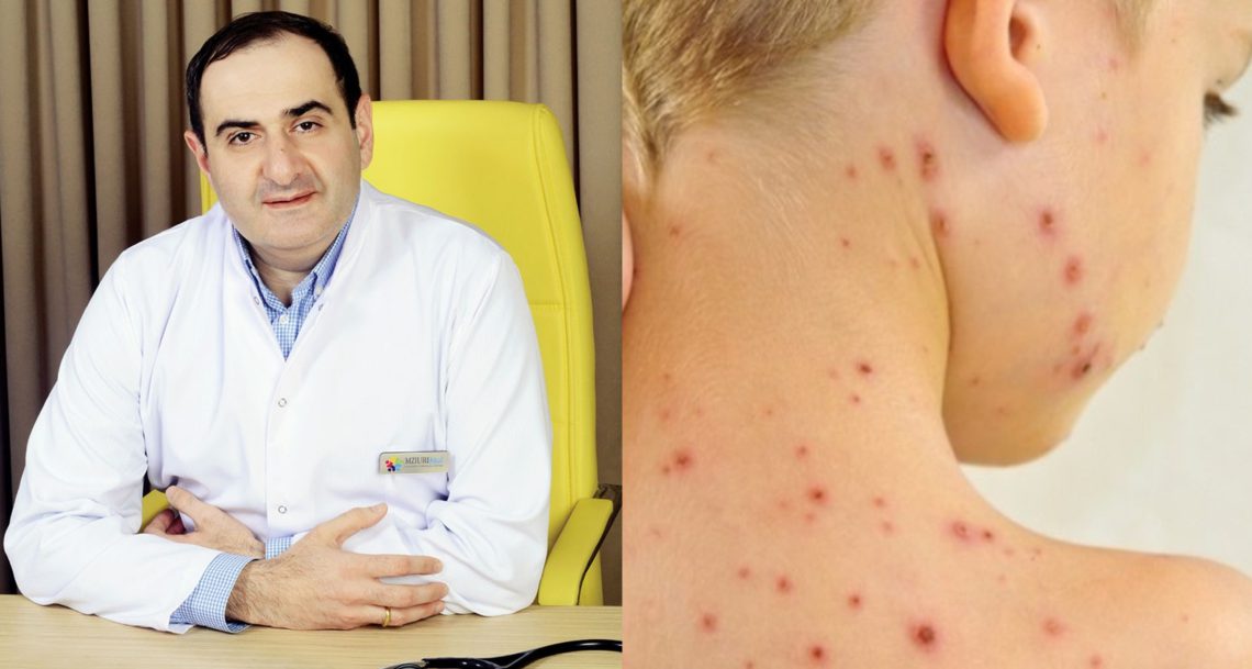 „შემთხვევებმა მოიმატა ბავშვებში“ – თემურ მიქელაძე