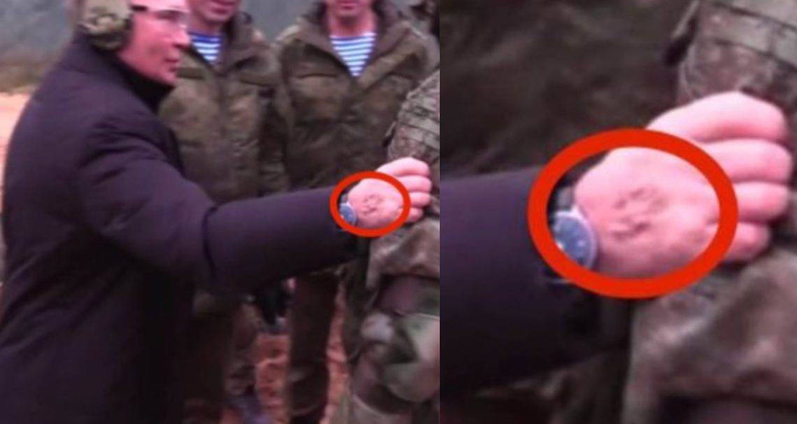 “მგონი ჟირინოვსკი გამოესახა, გააზიარეთ!” – დიდი ნაიარევი პუტინის ხელზე, რომელიც ინტერნეტ-სივრცეში განხილვის საგნად იქცა