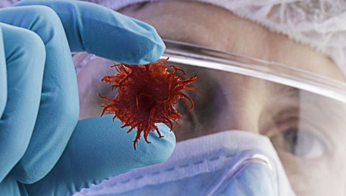 ჯანმრთელი ადამიანის სიმსივნით დაავადების 5 შესაძლო მიზეზი