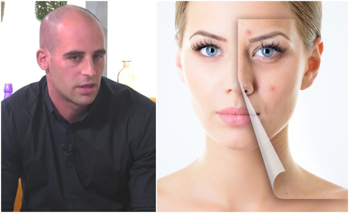 „რაც უფრო იშვიათად გამოიყენებენ, მით უკეთესი…“ – ზაზა თელია გვირჩევს, როგორ ავირიდოთ თავიდან გამონაყარი