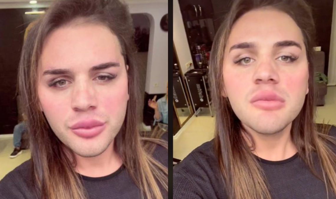 🎥”გუშინ უნდოდათ ჩემი დამახინჯება და მესროდნენ ბოთლებს”- პოლიტიკაში მოსვლის შესახებ მასხულიამ რამდენიმე დღის წინ განაცხადა