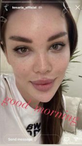 "ჭორფლები ძალიან გიხდება“ - რა ფოტოს აქვეყნებს კესარია აბრამიძე?