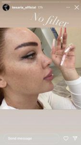 "ჭორფლები ძალიან გიხდება“ - რა ფოტოს აქვეყნებს კესარია აბრამიძე?