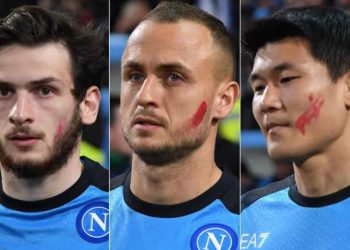 რას ნიშნავს წითელი ზოლი ხვიჩა კვარაცხელიასა და მისი თანაგუნდელების სახეზე?