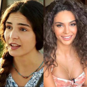 პოპულარული თურქი მსახიობები პლასტიკურ ოპერაციებამდე და ახლა