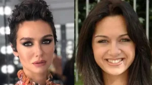 პოპულარული თურქი მსახიობები პლასტიკურ ოპერაციებამდე და ახლა