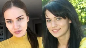 პოპულარული თურქი მსახიობები პლასტიკურ ოპერაციებამდე და ახლა