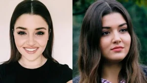 პოპულარული თურქი მსახიობები პლასტიკურ ოპერაციებამდე და ახლა