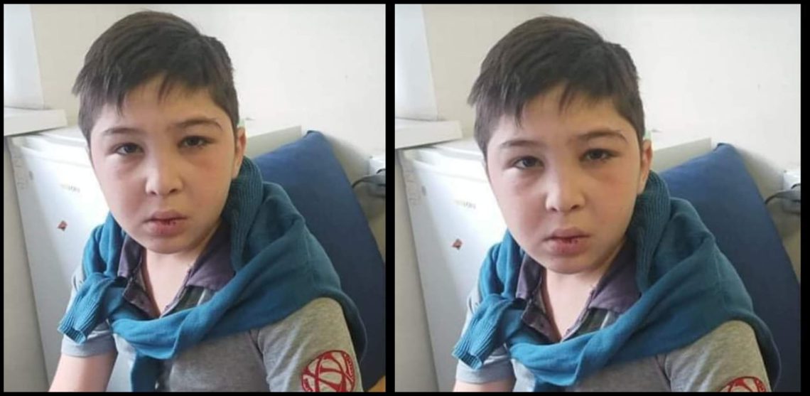 “გლოვობს მთელი საქართველო” – ვინ არის 13 წლის მოზარდი, რომელიც საფრანგეთშიც ვერ გადაარჩინეს