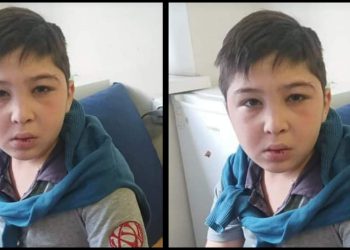 “გლოვობს მთელი საქართველო” – ვინ არის 13 წლის მოზარდი, რომელიც საფრანგეთშიც ვერ გადაარჩინეს