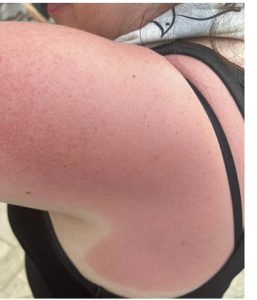 “ცოცხლად დამწვეს, არც ჩრდილში დაჯდომის უფლება მომცეს…" - რას წერს თამარ იარაჯული?