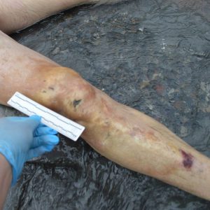 6 წელი სმიტების ოჯახის ტრაგედიიდან - რა ვიცით ხადას ხეობაში მომხდარ საზარელ დანაშაულზე