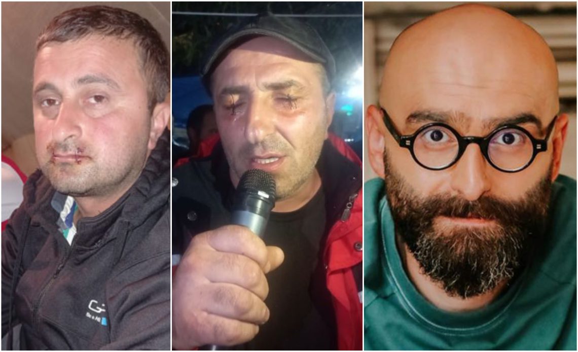 საგანგაშოა, რომ ამ ქვეყანაში ადამიანს თვალ-პირის ამოკერვა უწევს, რათა სახელმწიფომ, ქვეყანამ, ხალხმა მის გაუსაძლის ყოფას ყურადღება მიაქციოს – დათო გორგილაძე