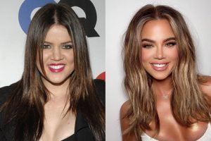 როგორ გამოიყურებოდნენ კარდაშიანები პლასტიკურ ქირურგიამდე - თვალებს არ დაუჯერებთ