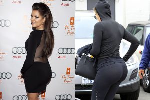 როგორ გამოიყურებოდნენ კარდაშიანები პლასტიკურ ქირურგიამდე - თვალებს არ დაუჯერებთ