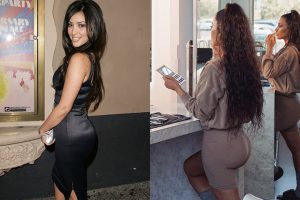 როგორ გამოიყურებოდნენ კარდაშიანები პლასტიკურ ქირურგიამდე - თვალებს არ დაუჯერებთ