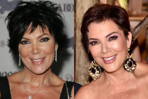 როგორ გამოიყურებოდნენ კარდაშიანები პლასტიკურ ქირურგიამდე - თვალებს არ დაუჯერებთ