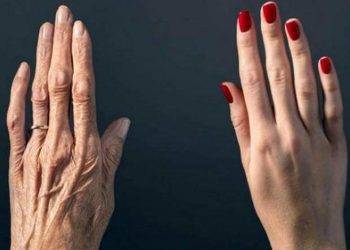 საოცარი რეცეპტი, რომელიც ხელებზე კანის დაბერების პროცესს შეაჩერებს!