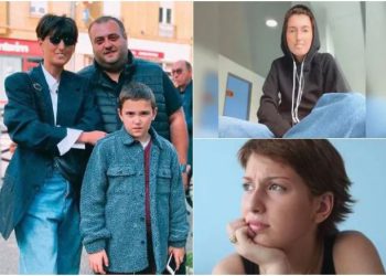 “მეკითხებიან, კბილები რატომ გაქვს ასე, გაკეთებას არ აპირებო? მირჩევენ, ტუჩებზე ფილერი გავიკეთო” – ცხოვრება სკლეროდერმიის დიაგნოზით: ქალი, რომელიც უიშვიათეს დაავადებას ებრძვის