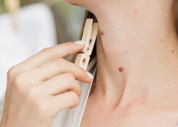 ის გეტყვით ყველაფერს თქვენს ბედზე – ნახეთ რას ნიშნავს თითოეული ხალი თქვენს სხეულზე