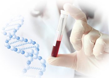 დაავადებები, რომლებიც თანამედროვე მეცნიერებისთვის საიდუმლოდ რჩება