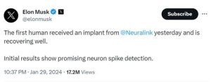 ჩიპის იმპლანტაცია ადამიანის ტვინში წარმატებით განახორციელა – რა ინფორმაციას ავრცელებს ილონ მასკი