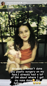 „არანაირი პლასტიკური ოპერაცია არ გამიკეთებია...“ - ნეკა დოროყაშვილი საზოგადოებას მიმართავს