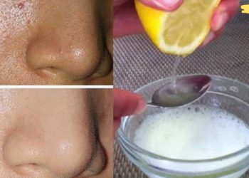 “თუ ამ ნიღბებს გამოიყენებთ, ნაოჭები და პიგმენტური ლაქები რამდენიმე დღეში ნაკლებად შესამჩნევი გახდება