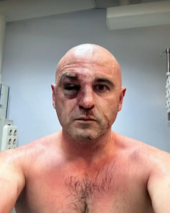 ๐ฅ "แ แฃแกแฃแแ แแแแแแแก" แกแแฌแแแแแฆแแแแแ แแฅแชแแแแ แแงแแคแ แแแแแ แฎแแแแแจแแแแ แแแแแชแแแแแแแ แกแแกแขแแแแ แกแชแแแแก - แแฎแแแแ แคแแขแ