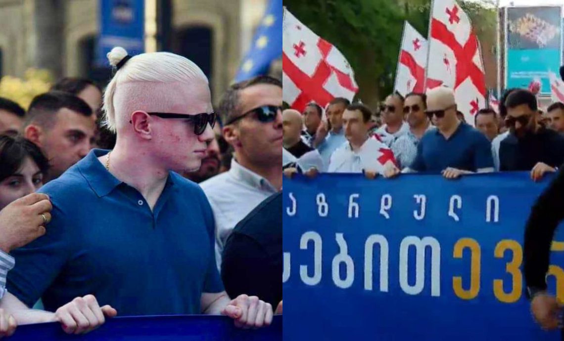 ๐ฅแ แแแแแแ แแชแแแแ แแชแแแแ แชแแขแแ แแแแแแจแแแแก?- แแแฎแแ แกแขแ แแขแแแแ, แ แแแแแแแช แแแแแแ แฅแแก แจแแแแก แแชแแแแแแ