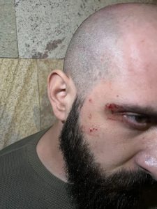 ჩელე ყურუა მასზე თავდასხმის შემდეგ პირველ კომენტარს აკეთებს - რა ვითარებაში დაესხნენ თავს ზონდერები?
