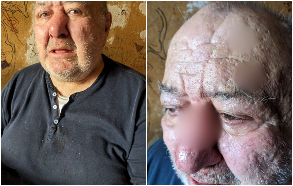 ზონდერებმა 73 წლის კაცი სცემეს – რა ინფორმაცია ვრცელდება ამ წუთებში?