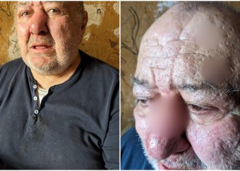 ზონდერებმა 73 წლის კაცი სცემეს – რა ინფორმაცია ვრცელდება ამ წუთებში?