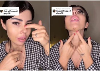 🎥 “ხრტილი აიღეს ცხვირიდან და ნიკაპზე გადამინერგეს” – რისი ოპერაცია გაიკეთა თამო ვაშალომიძემ?