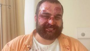 "ზონდერ-დაჯგუფებები დამესხნენ თავს... ეს არის რუსული მეთოდები"– ენმ-ის წევრი დიმა ჩიქოვანი მასზე თავდასხმის დეტალებს ჰყვება