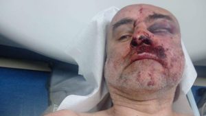 როგორია სასტიკად ნაცემი დავით ქაცარავას ჯანმრთელობის მდგომარეობა - უახლესი ცნობები საავადმყოფოდან